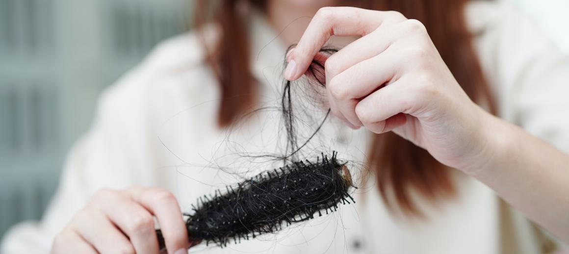 La desnutrición puede provocar la caída del cabello