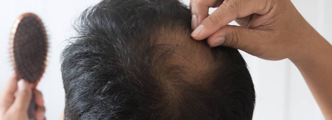 ¿Cuáles son las causas del debilitamiento y la caída del cabello?