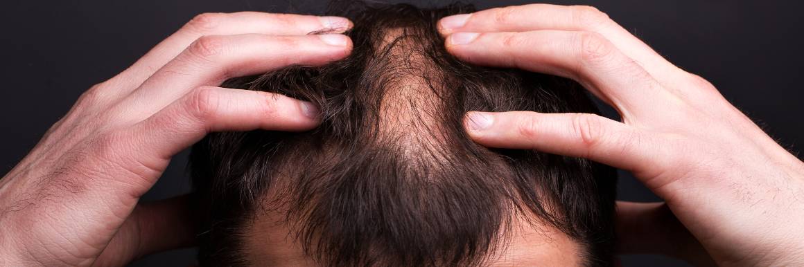 Reparación de los folículos pilosos dañados para un crecimiento sano del cabello